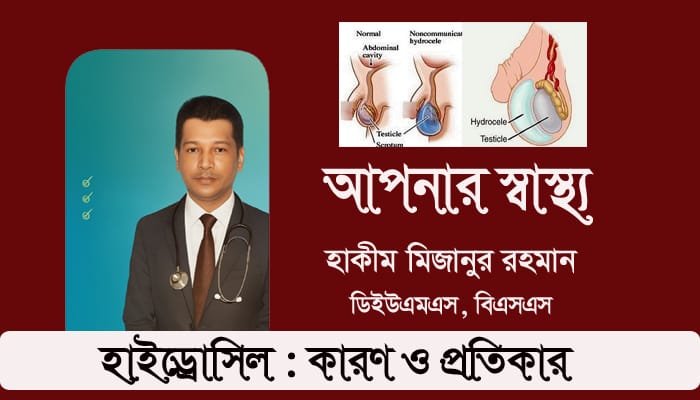 একশিরা বা হাইড্রোসিল রোগের কারণ ও প্রতিকার জেনে নিন