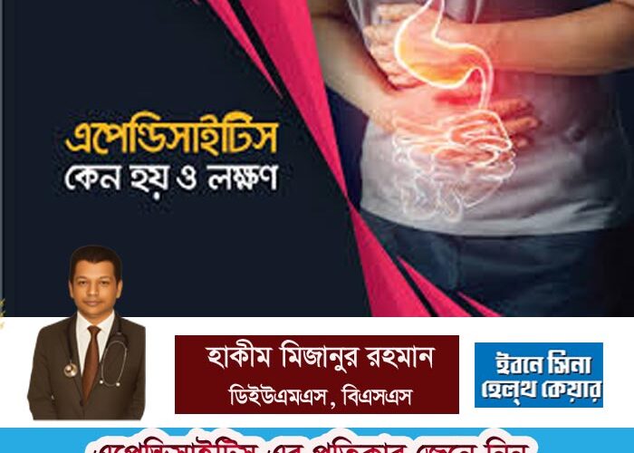 এপেন্ডিসাইটিস এর প্রতিকার জেনে নিন