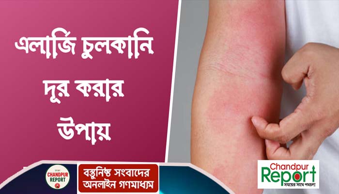 এলার্জির কারণ ও প্রতিকার জেনে নিন