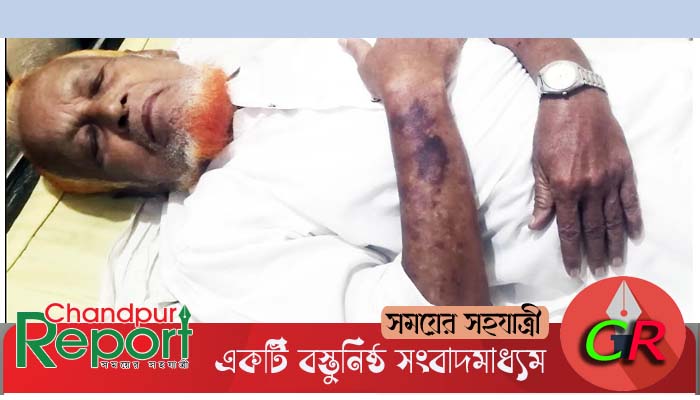 মধ্যযুগীয় কায়দায় বাবা-মায়ের উপর নির্যাতন, হাসপাতালে কাতরাচ্ছেন বাবা