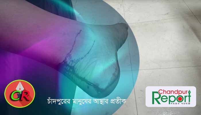 মতলব উত্তরে ব্যবসায়ীর পায়ের রগ কেটে দিয়েছে সন্ত্রাসীরা