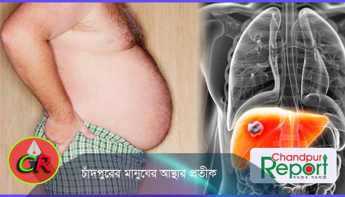 হজমের সমস্যাও হতে পারে ফ্যাটি লিভারের লক্ষণ