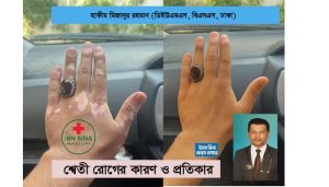 শ্বেতী রোগ: কারণ, প্রতিকার এবং হাকীম মিজানুর রহমানের চিকিৎসা পদ্ধতির সফলতা