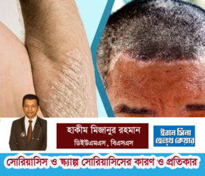 সোরিয়াসিস রোগের কারণ ও প্রতিকার জেনে নিন