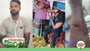 কাঁঠাল পাড়াকে কেন্দ্র করে বোনকে হত্যাচেষ্টা, বাঁচাতে গিয়ে মেয়ের জামাইকে কুপিয়ে জখম